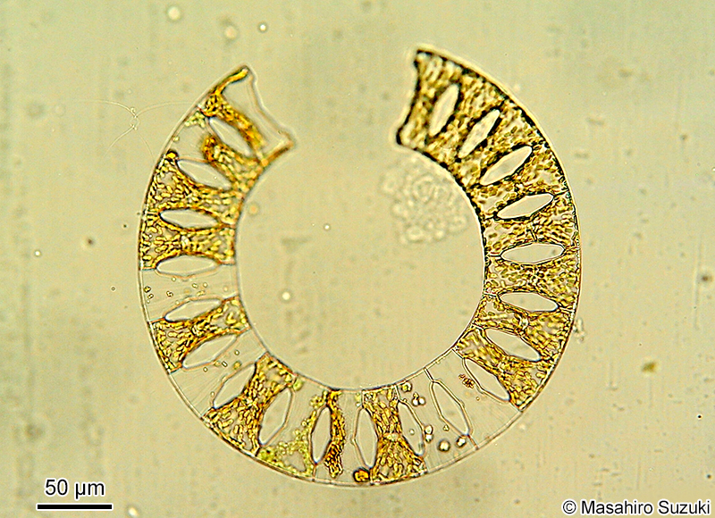 ハシゴケイソウ Eucampia zodiacus