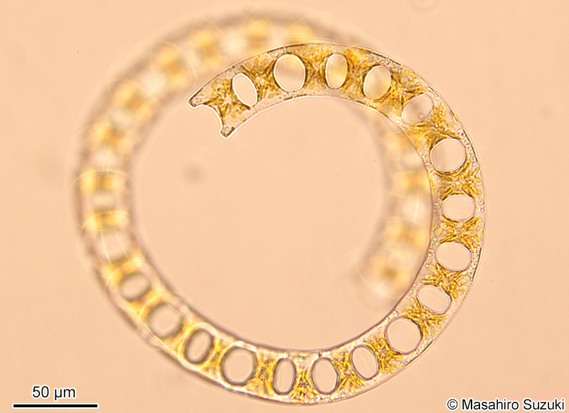 ハシゴケイソウ Eucampia zodiacus