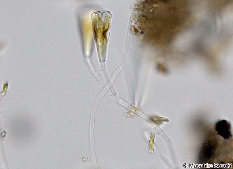 クサビケイソウ Gomphonema