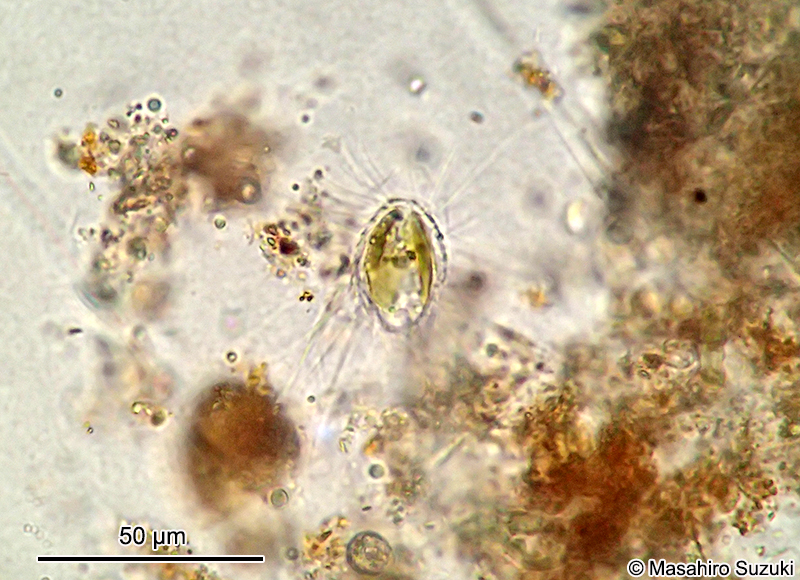 Mallomonas papillosa