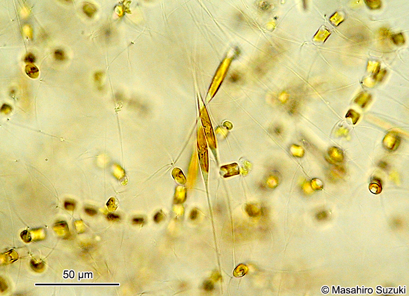 ハリササノハケイソウ Nitzchia longissima