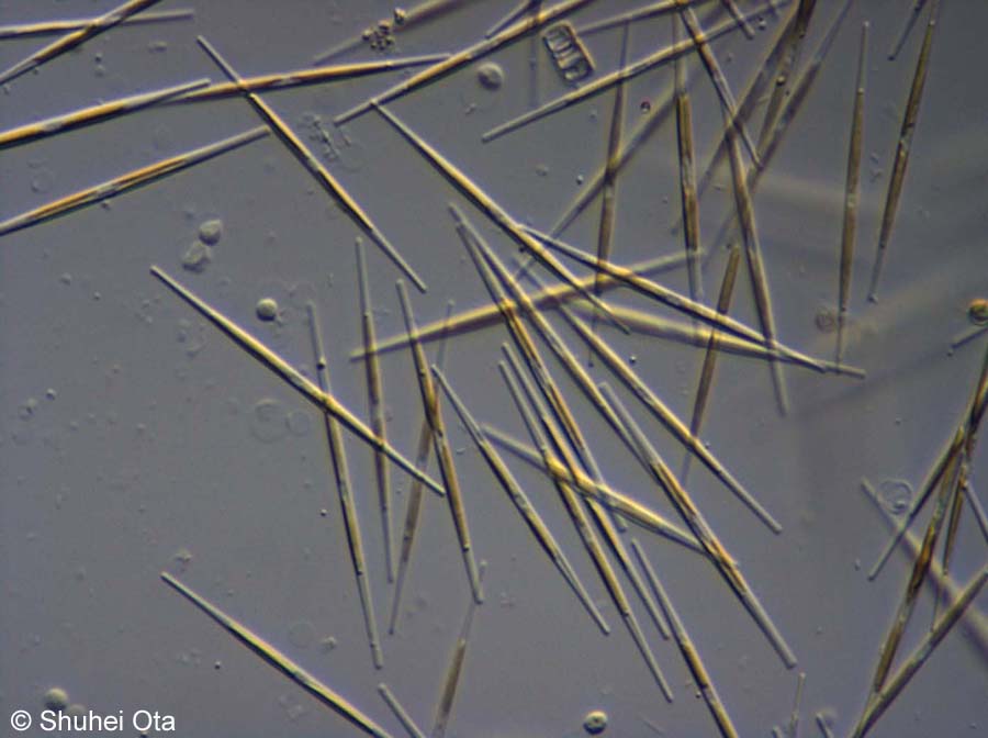 ササノハケイソウ Nitzchia