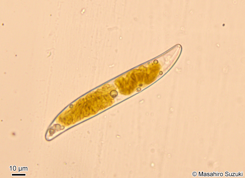 Pleurosigma sp.（底生）