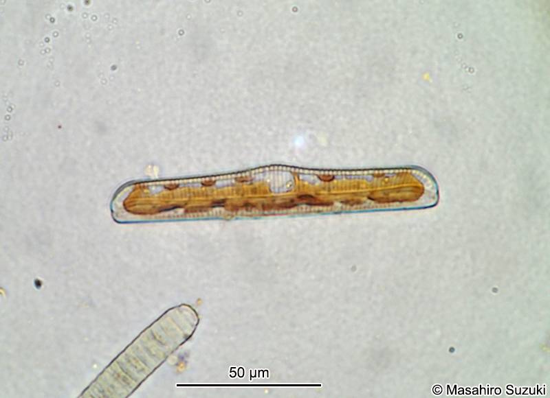 クシガタケイソウ属の1種 Rhopalodia ap.