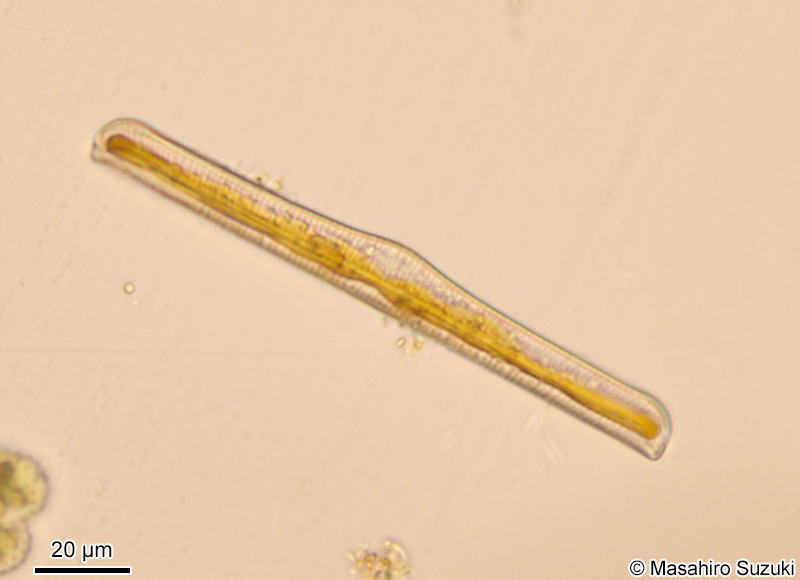 クシガタケイソウ属の1種 Rhopalodia ap.