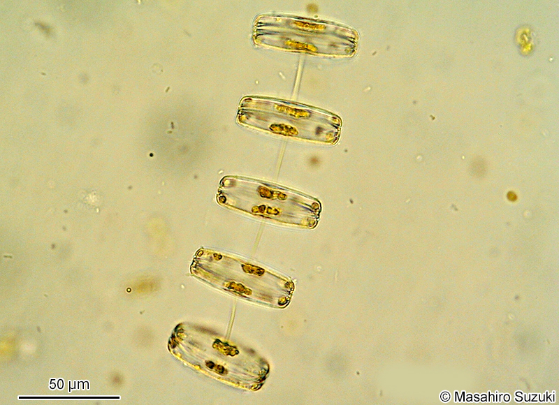 フトイトゼニケイソウ Thalassiosira rotula