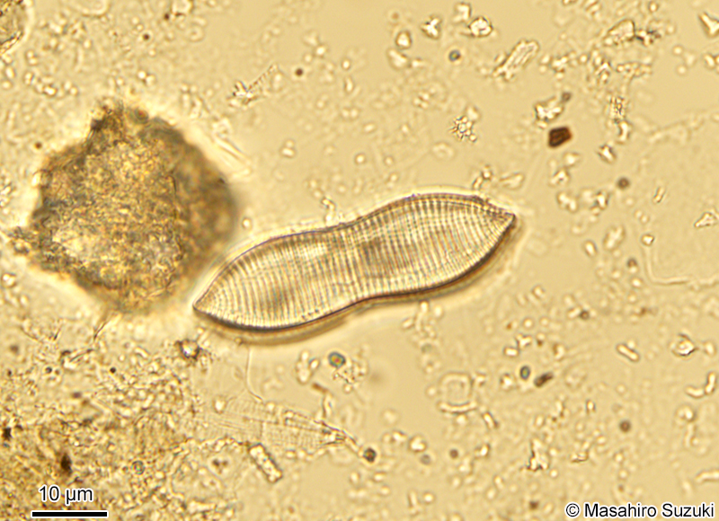 Tryblionella sp.