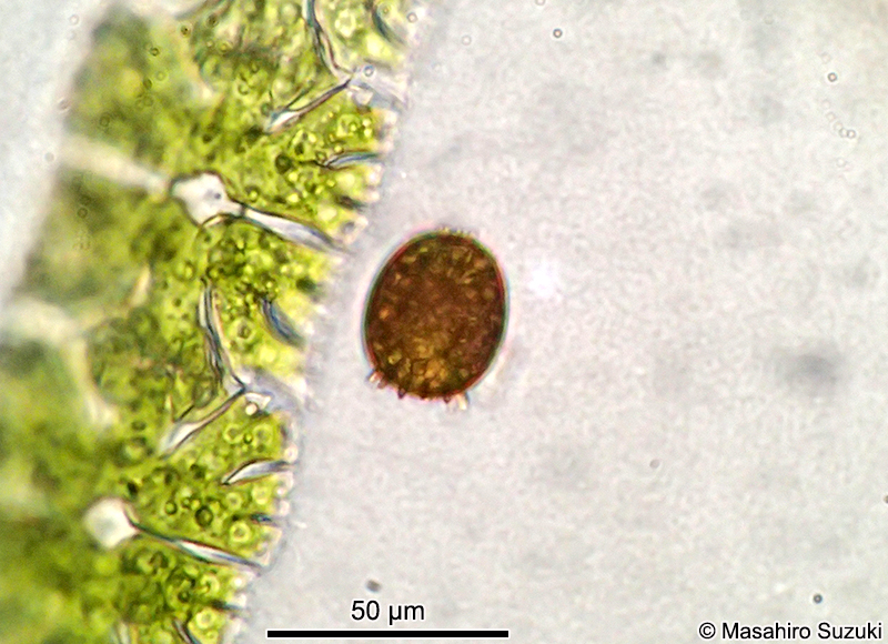 Trachelomonas armata