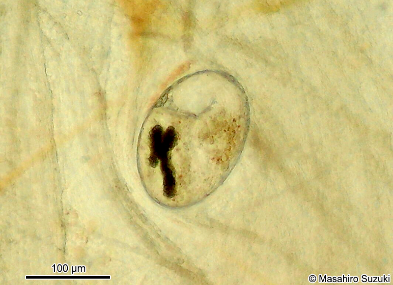 後睾吸虫目 Opisthorchiidaのメタセルカリア