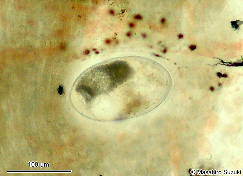 後睾吸虫目 Opisthorchiidaのメタセルカリア