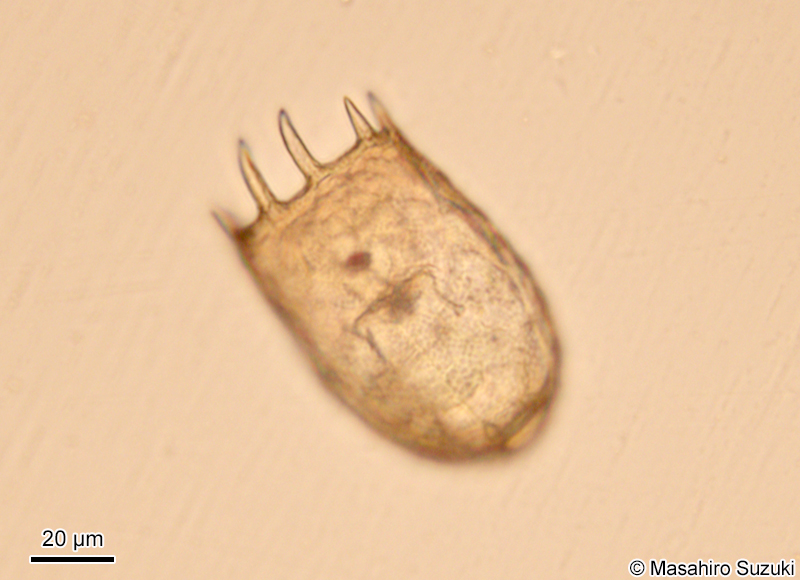 カメノコウワムシ Keratella cochlearis