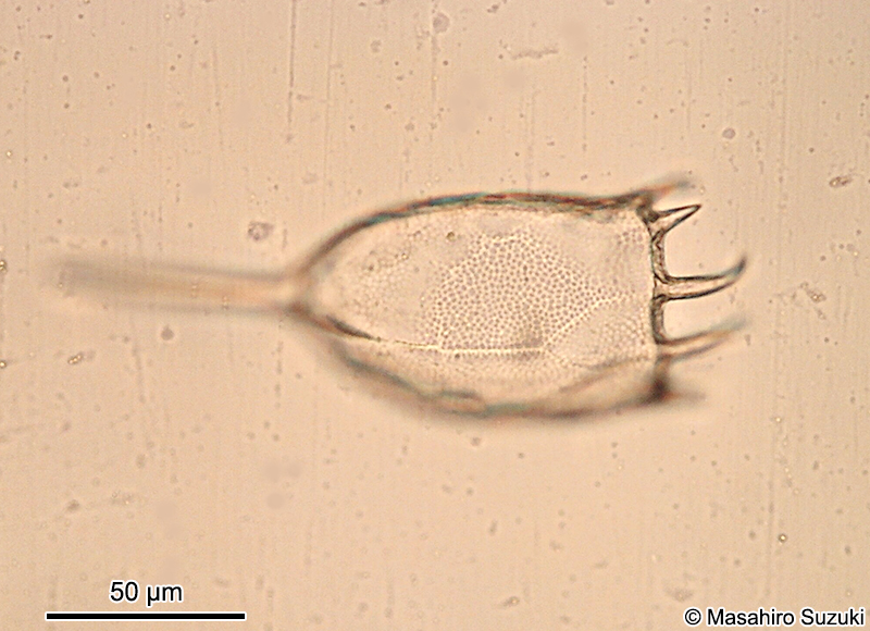 カメノコウワムシ Keratella cochlearis