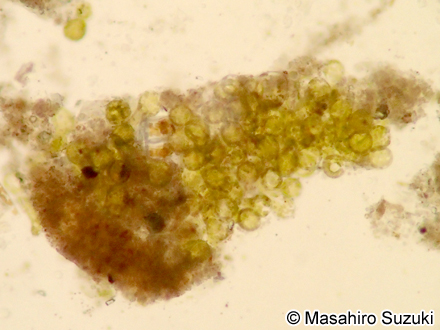 ミドリアマモウミウシの背側突起内の盗葉緑体