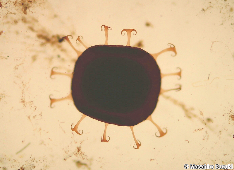 オオマリコケムシのスタトブラスト（休芽）