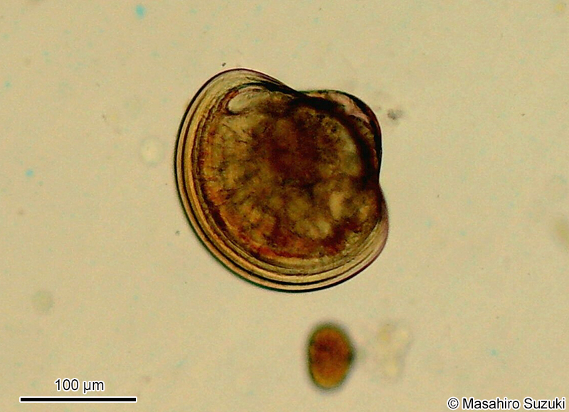 二枚貝のベリジャー幼生 Veliger larva