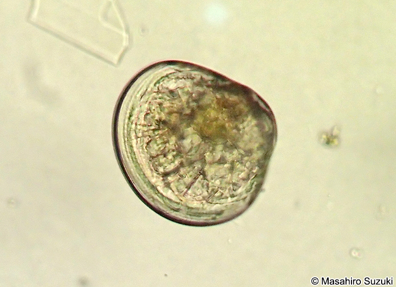 二枚貝のベリジャー幼生 Veliger larva