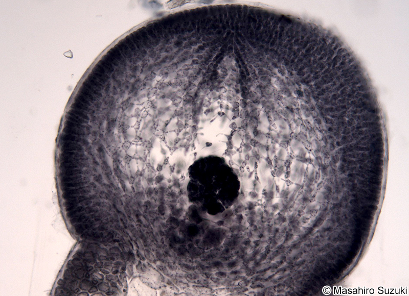 若い嚢果の縦断面