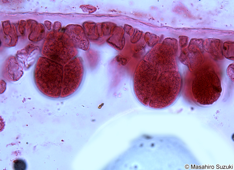 四分胞子嚢を付けた枝の縦断面