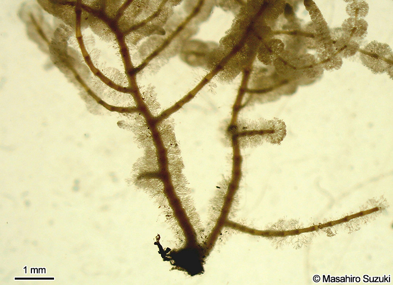 付着器及び体下部の写真