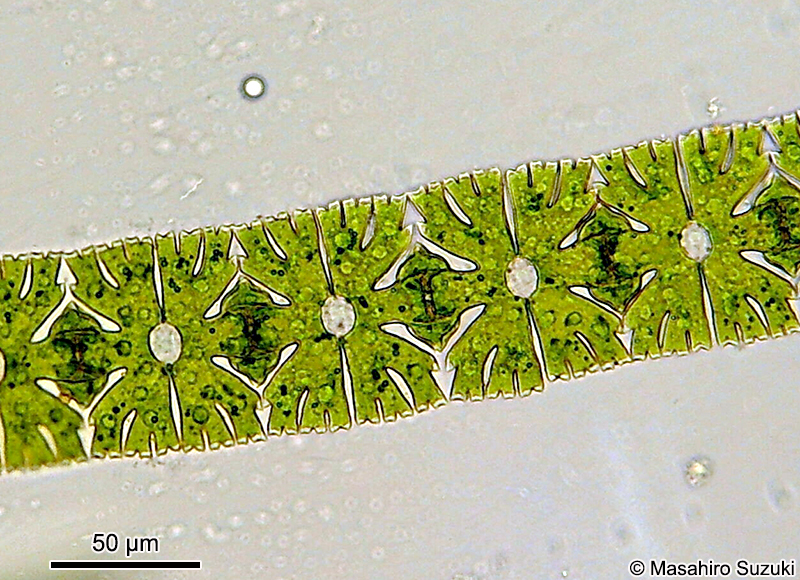 Micrasterias foliacea