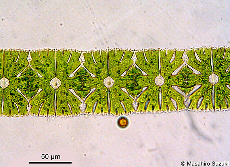 Micrasterias foliacea