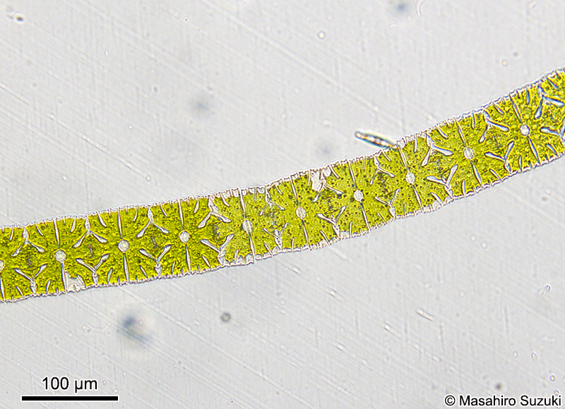 Micrasterias foliacea