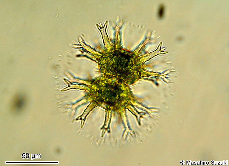 Staurastrum arctiscon