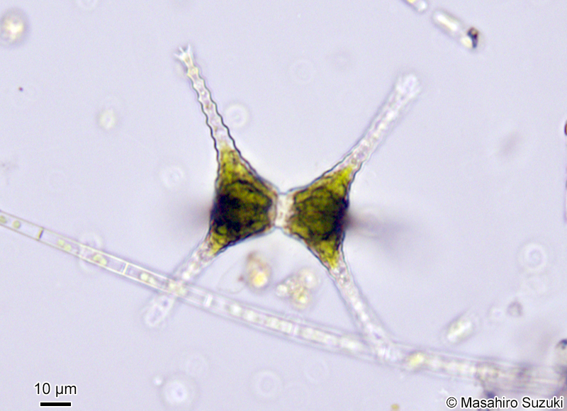 Staurastrum dorsidentiferum