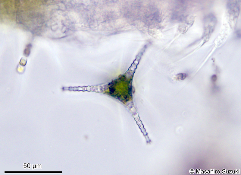 Staurastrum dorsidentiferum