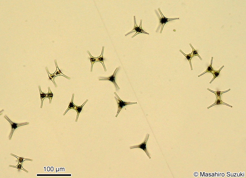 Staurastrum dorsidentiferum