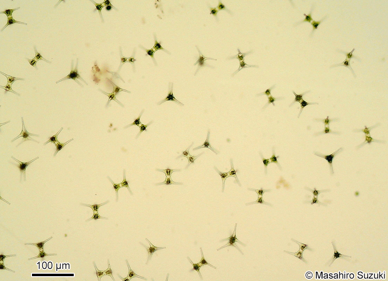 Staurastrum dorsidentiferum