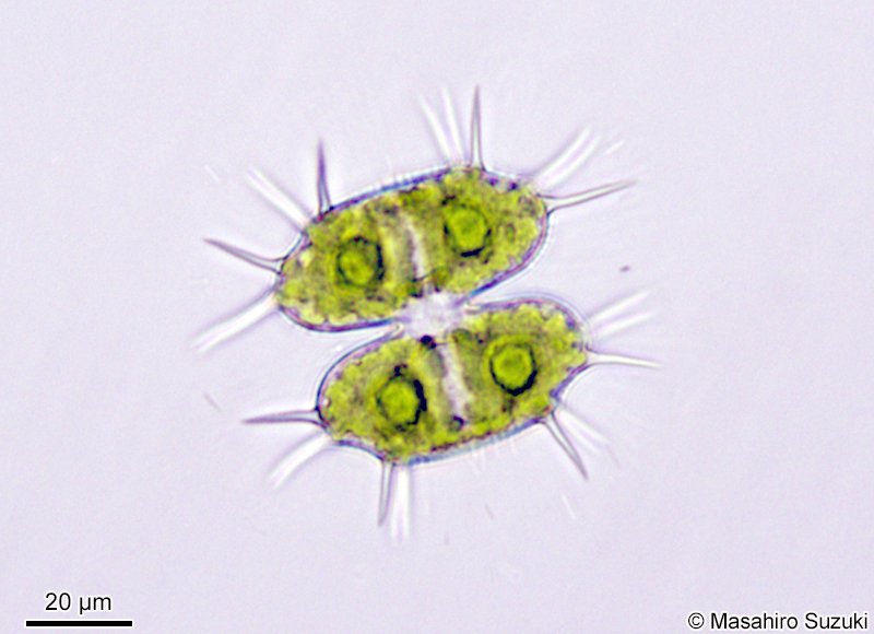 Xanthidium antilopaeum