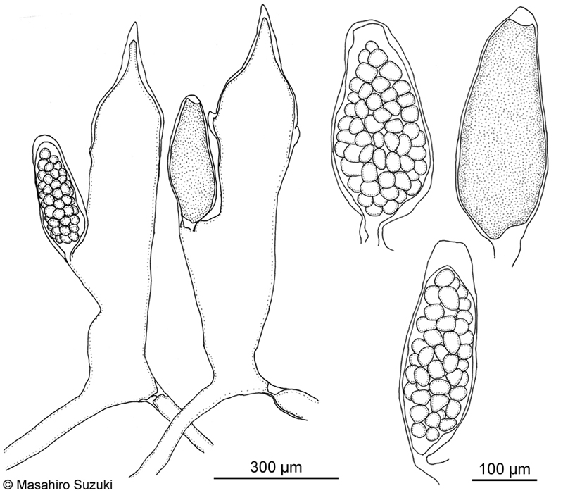 配偶子嚢を付けた小嚢と配偶子嚢